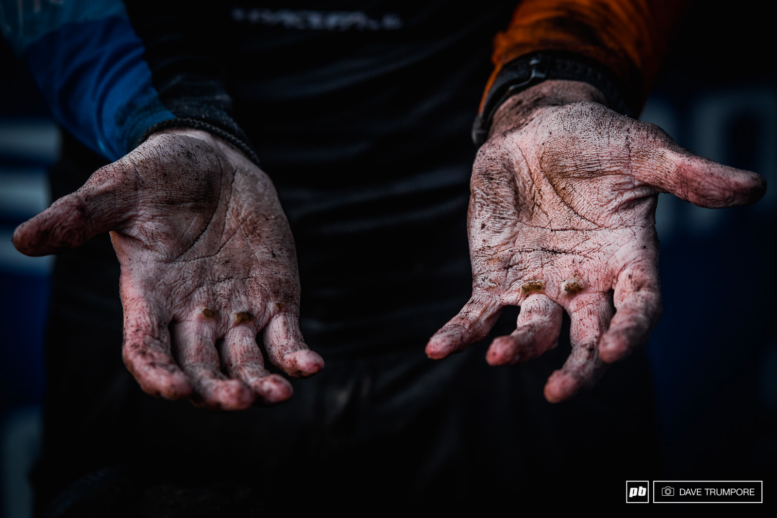 Les mains de Greg Callaghan après la course… bien qu’il ait changé ses gants trempés après chaque spéciale. © Dave Trumpore